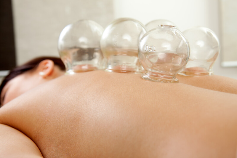 cupping therapy in portsmouth maine